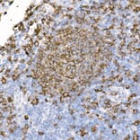Immunohistochemistry - Anti-CD20 Antibody [ARC51683] (A306625) - Antibodies.com
