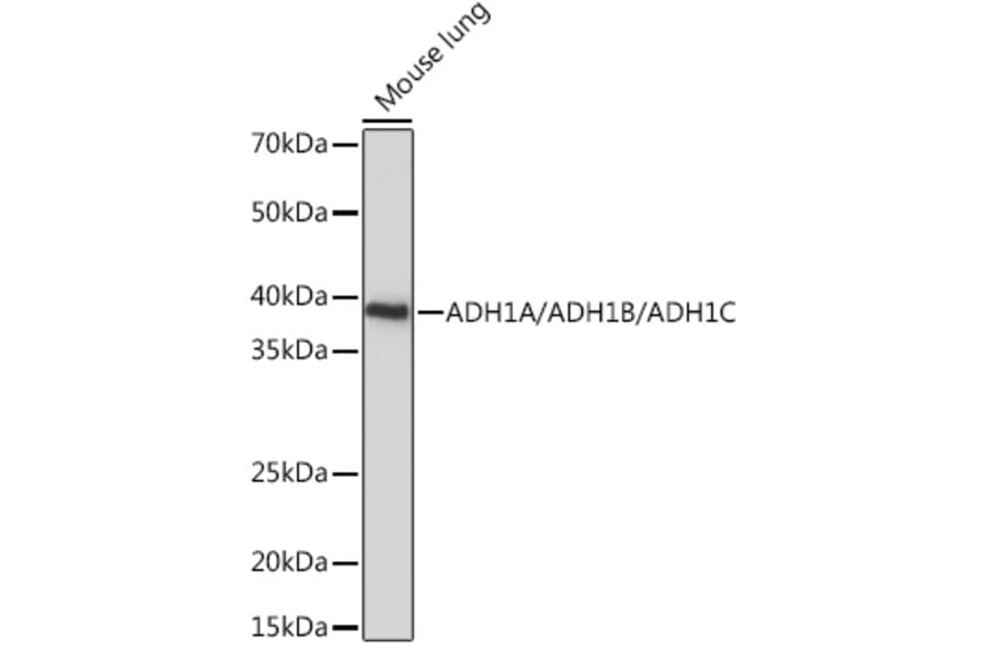 Western Blot - Anti-Alcohol Dehydrogenase + ADH1B + ADH1C Antibody (A306626) - Antibodies.com