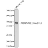 Western Blot - Anti-Alcohol Dehydrogenase + ADH1B + ADH1C Antibody (A306626) - Antibodies.com