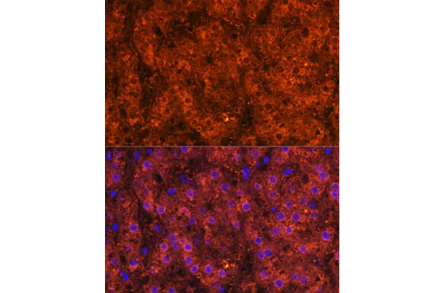 Immunofluorescence - Anti-Alcohol Dehydrogenase + ADH1B + ADH1C Antibody (A306626) - Antibodies.com