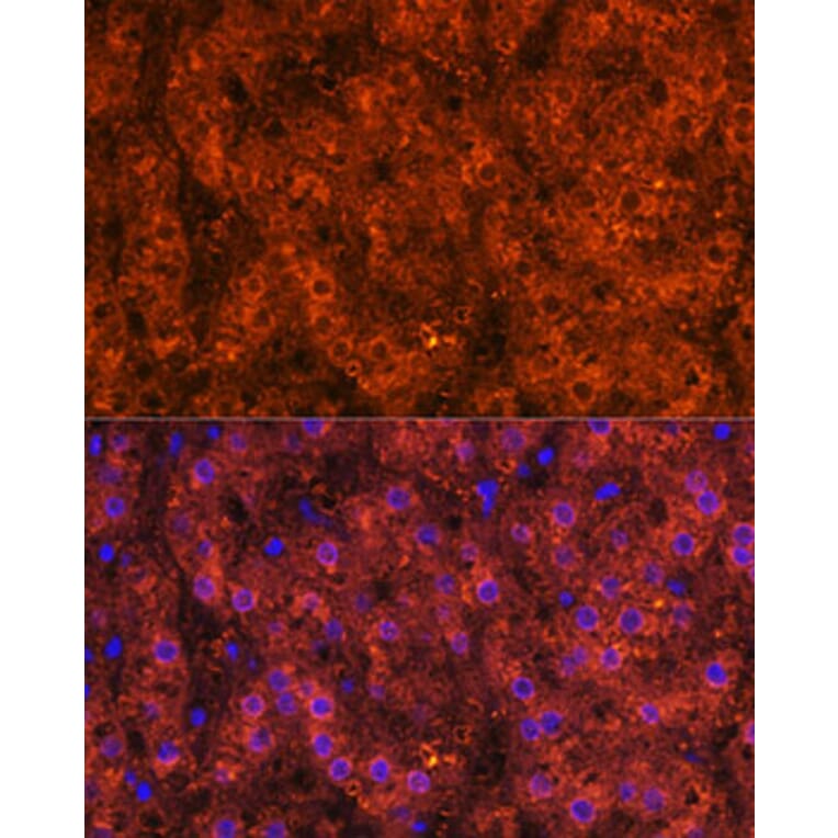 Immunofluorescence - Anti-Alcohol Dehydrogenase + ADH1B + ADH1C Antibody (A306626) - Antibodies.com