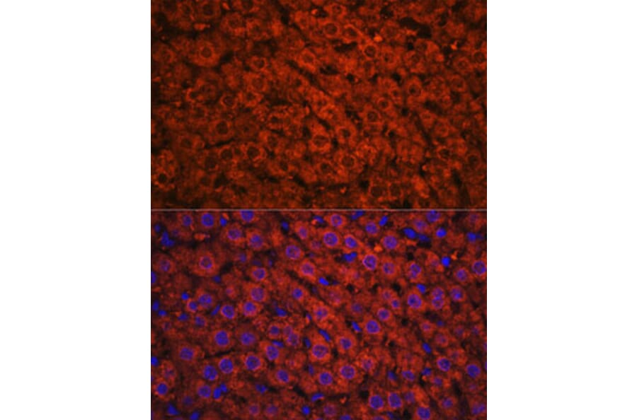Immunofluorescence - Anti-Alcohol Dehydrogenase + ADH1B + ADH1C Antibody (A306626) - Antibodies.com