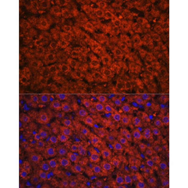 Immunofluorescence - Anti-Alcohol Dehydrogenase + ADH1B + ADH1C Antibody (A306626) - Antibodies.com