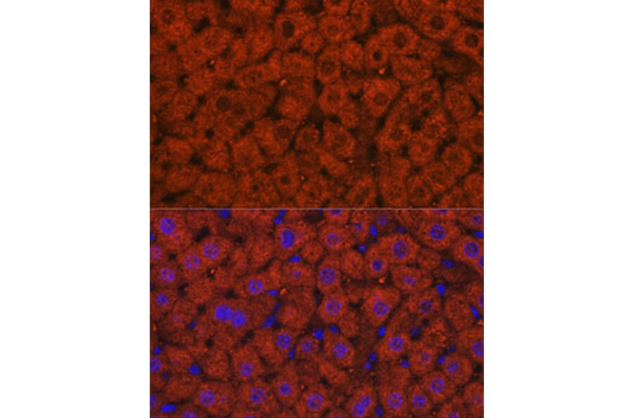 Immunofluorescence - Anti-Alcohol Dehydrogenase + ADH1B + ADH1C Antibody (A306626) - Antibodies.com