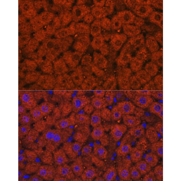 Immunofluorescence - Anti-Alcohol Dehydrogenase + ADH1B + ADH1C Antibody (A306626) - Antibodies.com