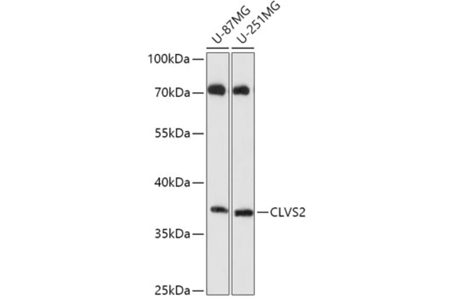 Western Blot - Anti-CLVS2 Antibody (A306627) - Antibodies.com