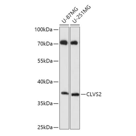 Western Blot - Anti-CLVS2 Antibody (A306627) - Antibodies.com