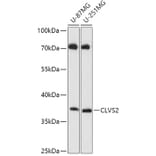 Western Blot - Anti-CLVS2 Antibody (A306627) - Antibodies.com