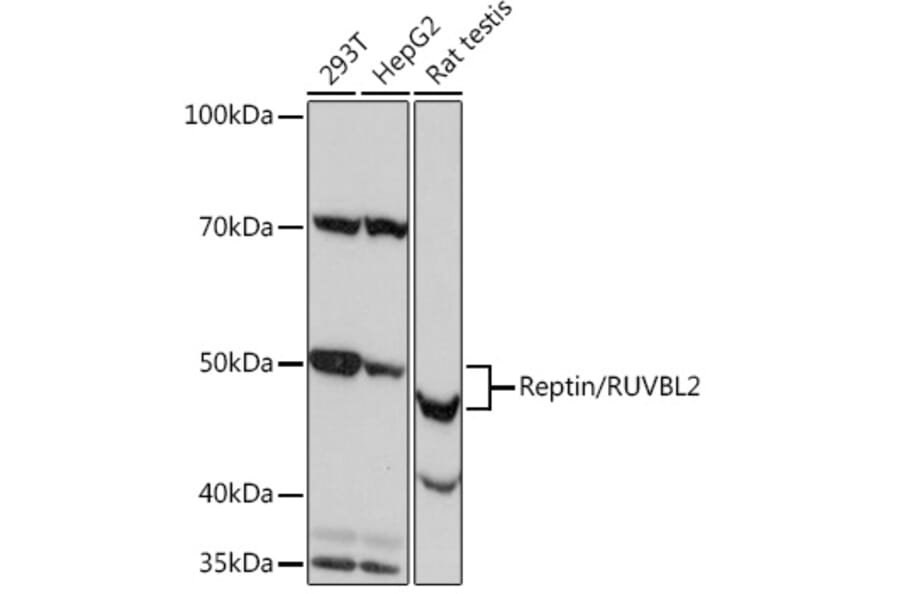 Western Blot - Anti-Reptin/TIP49B/RUVB2 Antibody [ARC0933] (A306628) - Antibodies.com