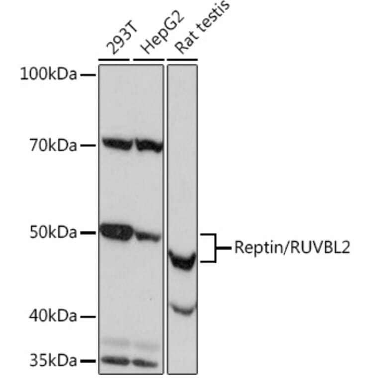 Western Blot - Anti-Reptin/TIP49B/RUVB2 Antibody [ARC0933] (A306628) - Antibodies.com