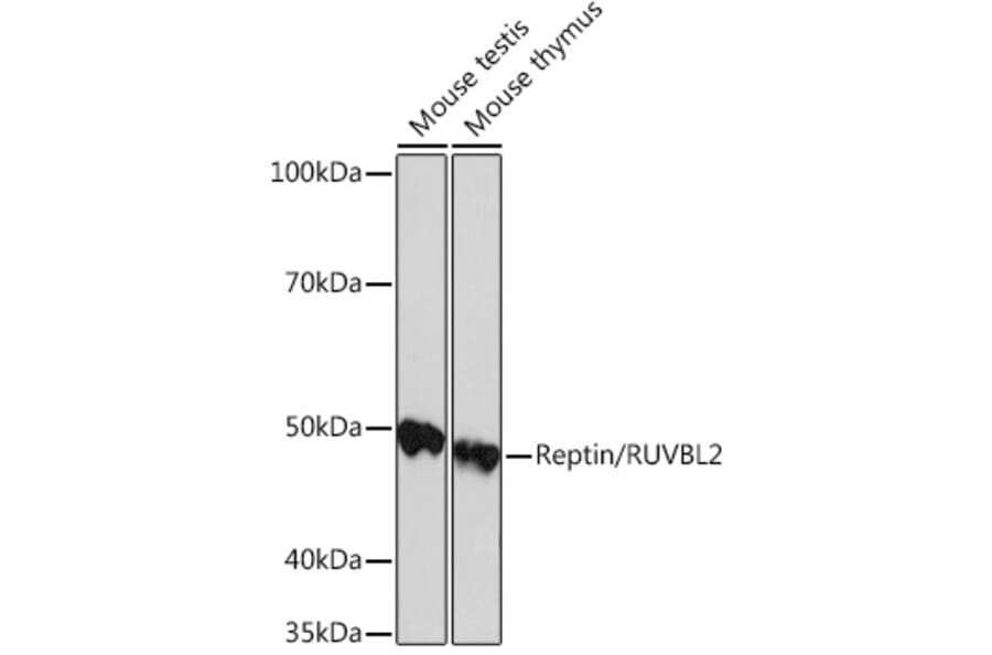 Western Blot - Anti-Reptin/TIP49B/RUVB2 Antibody [ARC0933] (A306628) - Antibodies.com