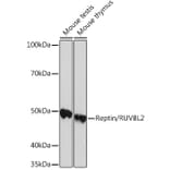 Western Blot - Anti-Reptin/TIP49B/RUVB2 Antibody [ARC0933] (A306628) - Antibodies.com