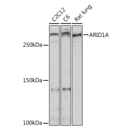 Western Blot - Anti-ARID1A Antibody (A306631) - Antibodies.com