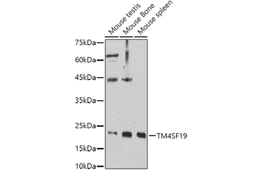 Western Blot - Anti-TM4SF19 Antibody (A306632) - Antibodies.com