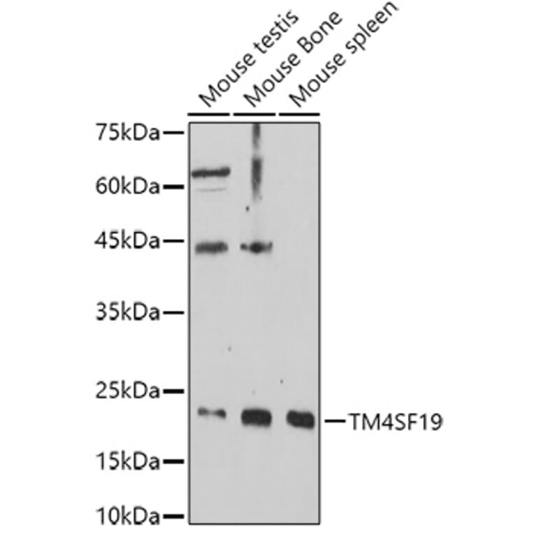 Western Blot - Anti-TM4SF19 Antibody (A306632) - Antibodies.com
