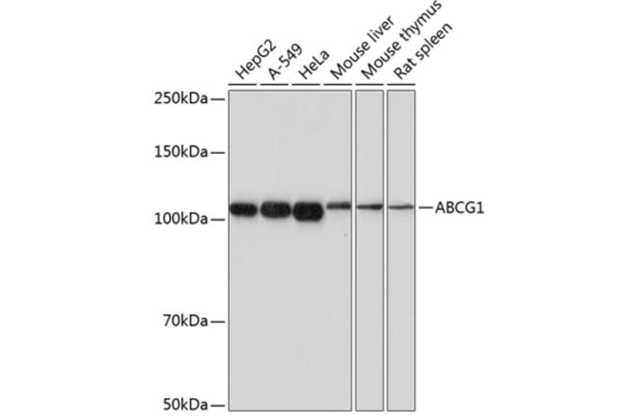 Western Blot - Anti-ABCG1 Antibody [ARC0336] (A306633) - Antibodies.com