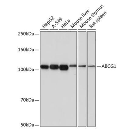 Western Blot - Anti-ABCG1 Antibody [ARC0336] (A306633) - Antibodies.com