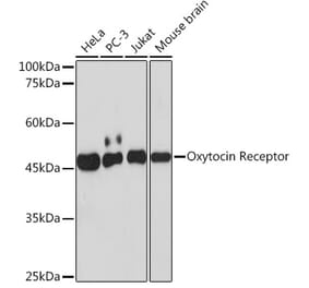 Western Blot - Anti-Oxytocin Receptor Antibody [ARC2266] (A306634) - Antibodies.com
