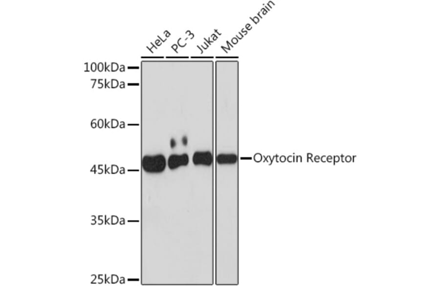 Western Blot - Anti-Oxytocin Receptor Antibody [ARC2266] (A306634) - Antibodies.com