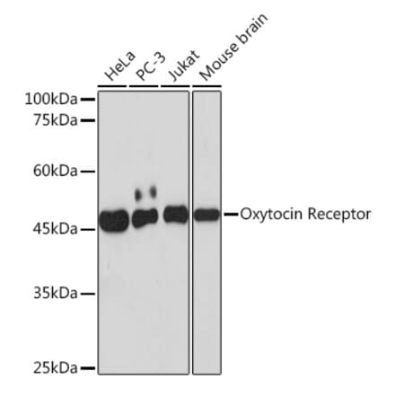 Western Blot - Anti-Oxytocin Receptor Antibody [ARC2266] (A306634) - Antibodies.com