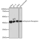 Western Blot - Anti-Oxytocin Receptor Antibody [ARC2266] (A306634) - Antibodies.com