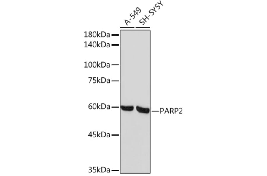 Western Blot - Anti-PARP2 Antibody [ARC2099] (A306636) - Antibodies.com
