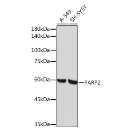 Western Blot - Anti-PARP2 Antibody [ARC2099] (A306636) - Antibodies.com