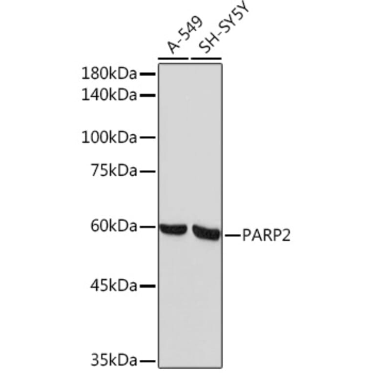 Western Blot - Anti-PARP2 Antibody [ARC2099] (A306636) - Antibodies.com