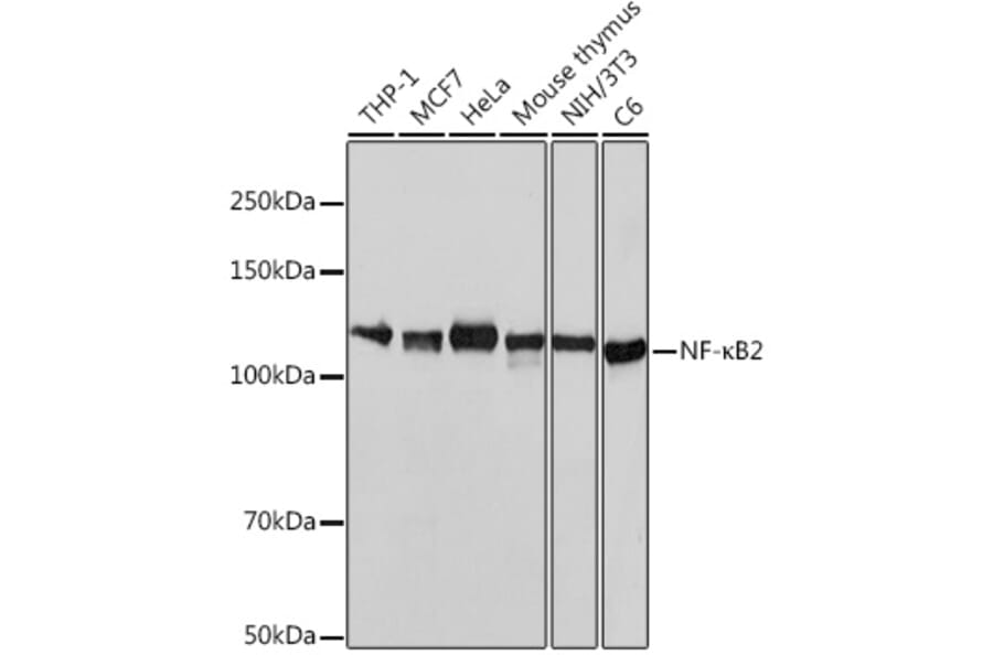 Western Blot - Anti-NFkB p100/NFKB2 Antibody [ARC0084] (A306637) - Antibodies.com