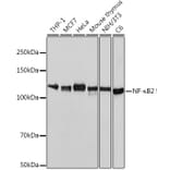 Western Blot - Anti-NFkB p100/NFKB2 Antibody [ARC0084] (A306637) - Antibodies.com