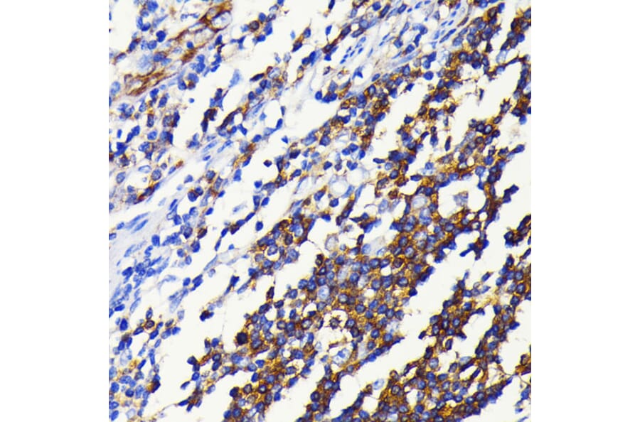 Immunohistochemistry - Anti-NFkB p100/NFKB2 Antibody [ARC0084] (A306637) - Antibodies.com