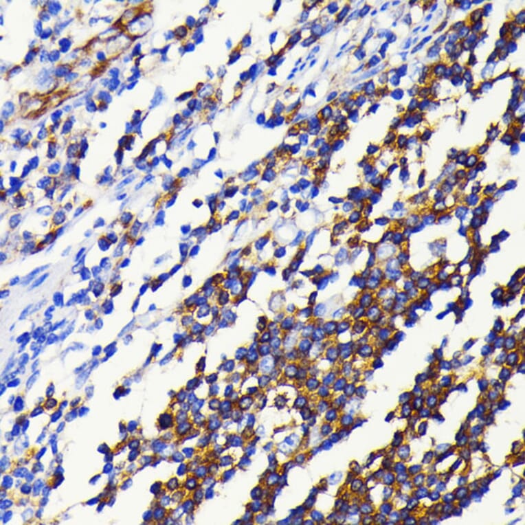 Immunohistochemistry - Anti-NFkB p100/NFKB2 Antibody [ARC0084] (A306637) - Antibodies.com
