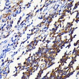 Immunohistochemistry - Anti-NFkB p100/NFKB2 Antibody [ARC0084] (A306637) - Antibodies.com