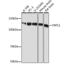 Western Blot - Anti-TRPC1 Antibody [ARC0884] (A306639) - Antibodies.com