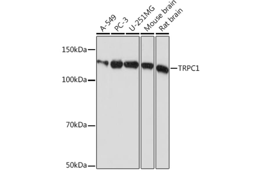 Western Blot - Anti-TRPC1 Antibody [ARC0884] (A306639) - Antibodies.com