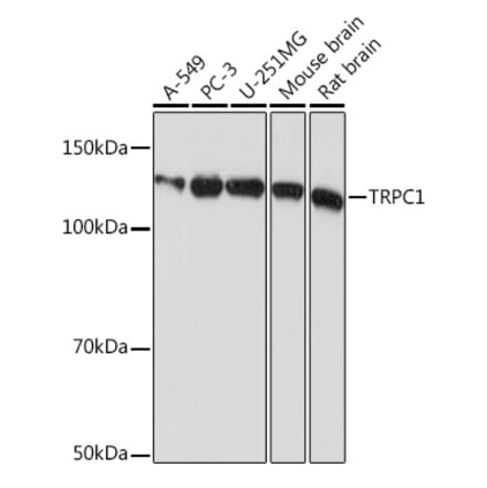 Western Blot - Anti-TRPC1 Antibody [ARC0884] (A306639) - Antibodies.com