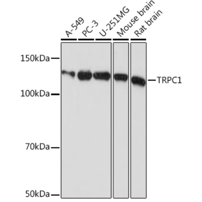 Western Blot - Anti-TRPC1 Antibody [ARC0884] (A306639) - Antibodies.com