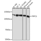 Western Blot - Anti-TRPC1 Antibody [ARC0884] (A306639) - Antibodies.com
