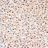 Immunohistochemistry - Anti-Apc6 Antibody [ARC2053] (A306640) - Antibodies.com