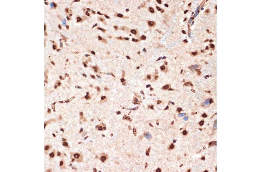 Immunohistochemistry - Anti-Apc6 Antibody [ARC2053] (A306640) - Antibodies.com
