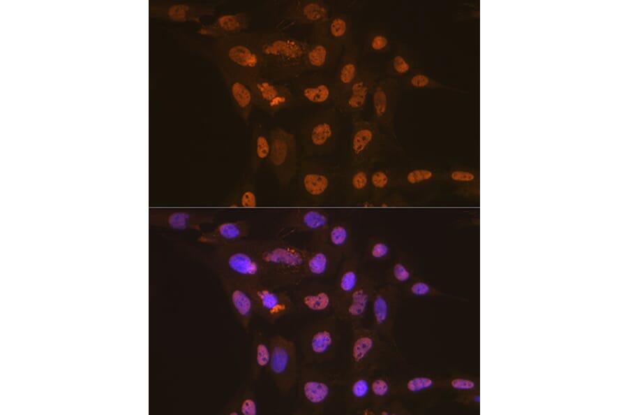 Immunofluorescence - Anti-Apc6 Antibody [ARC2053] (A306640) - Antibodies.com