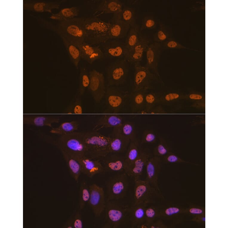 Immunofluorescence - Anti-Apc6 Antibody [ARC2053] (A306640) - Antibodies.com