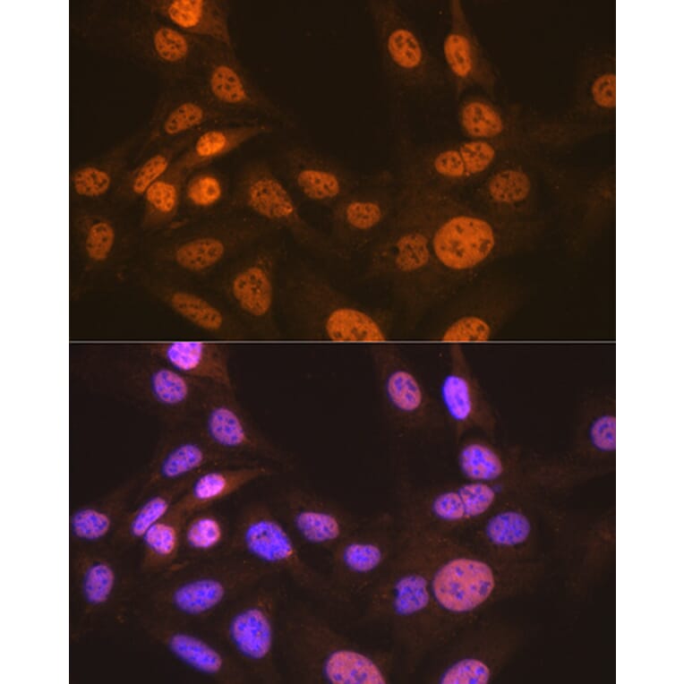 Immunofluorescence - Anti-Apc6 Antibody [ARC2053] (A306640) - Antibodies.com