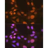 Immunofluorescence - Anti-Apc6 Antibody [ARC2053] (A306640) - Antibodies.com
