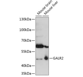 Western Blot - Anti-GALR2 Antibody (A306641) - Antibodies.com