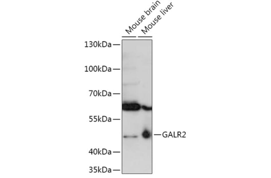 Western Blot - Anti-GALR2 Antibody (A306641) - Antibodies.com