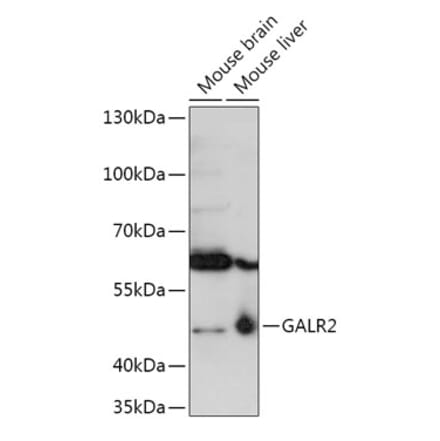 Western Blot - Anti-GALR2 Antibody (A306641) - Antibodies.com