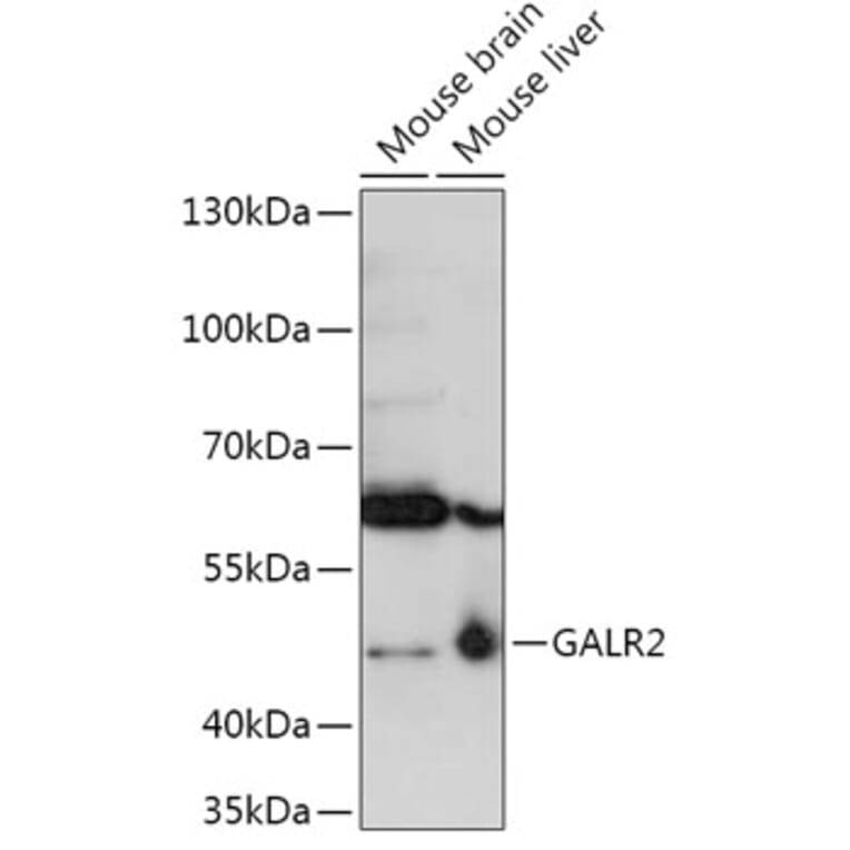 Western Blot - Anti-GALR2 Antibody (A306641) - Antibodies.com