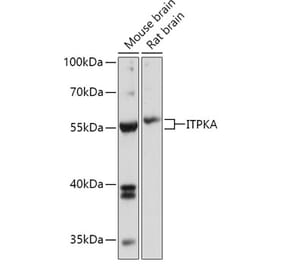 Western Blot - Anti-ITPKA Antibody (A306642) - Antibodies.com