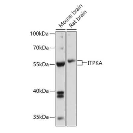 Western Blot - Anti-ITPKA Antibody (A306642) - Antibodies.com